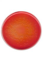 محیط کشت آگار مکانکی برند مرک بسته 500 گرمی