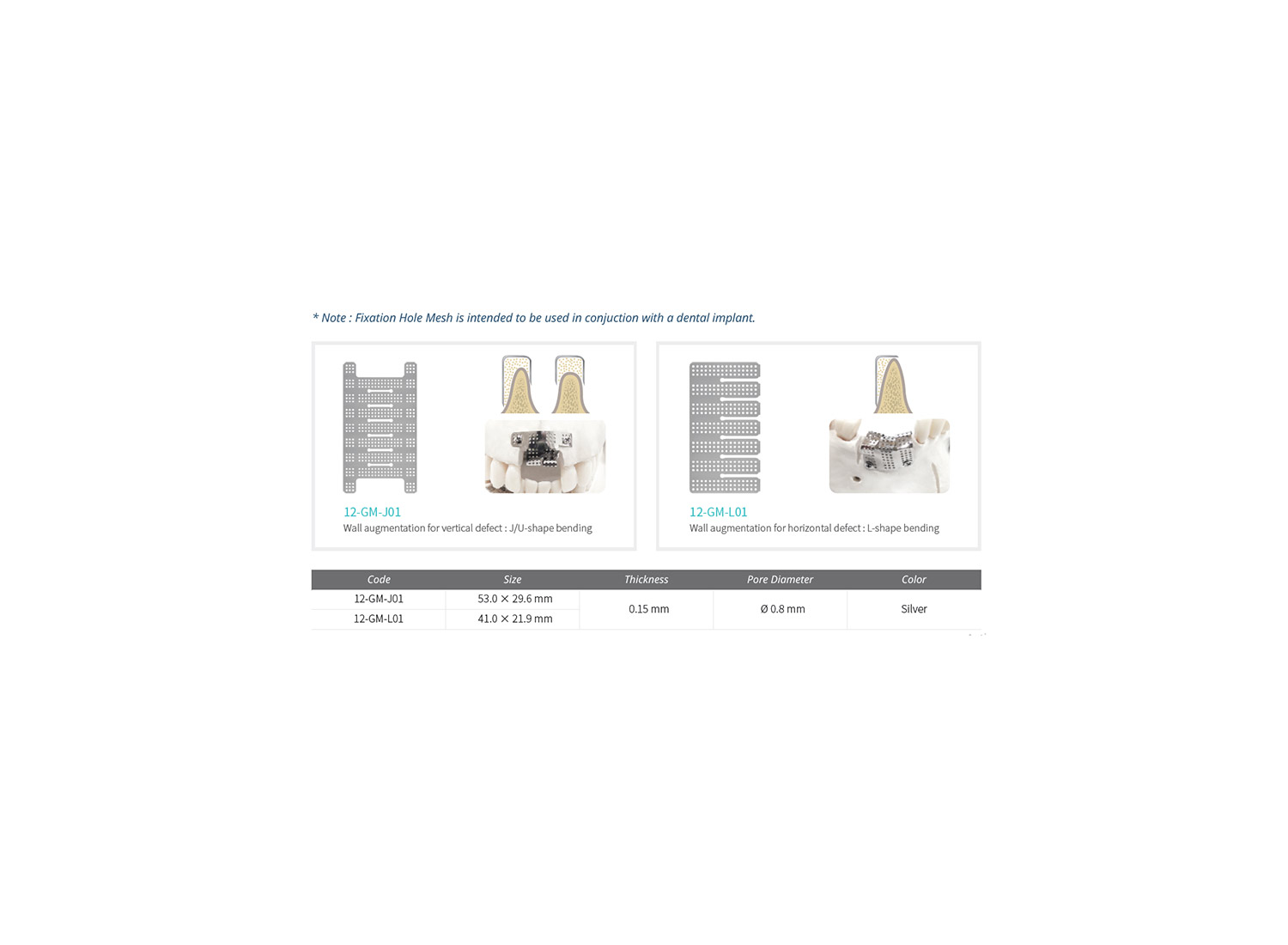 مش خمشی صاف افقی Horizontal Smooth Bending mesh برند GBR